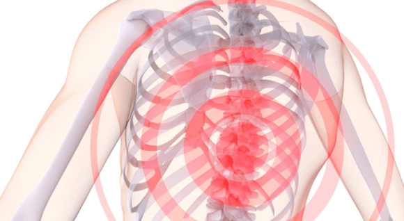 spine pain with thoracic osteochondrosis