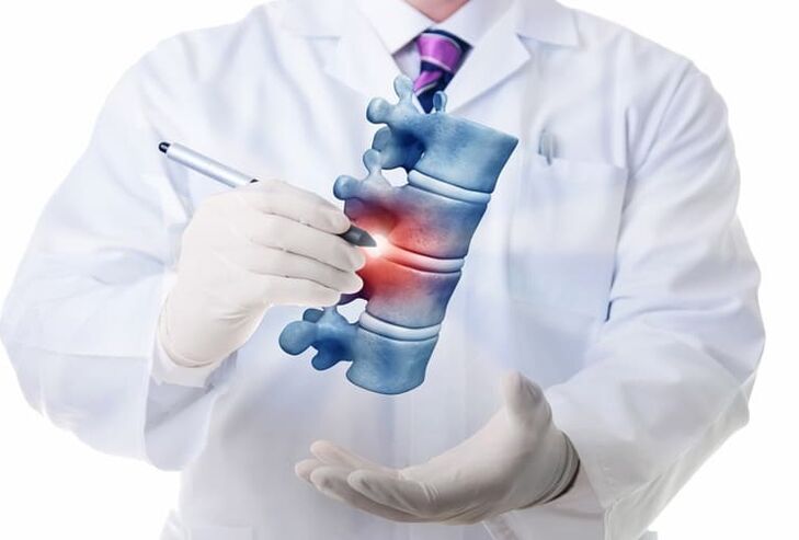 spinal cord injury in thoracic osteochondrosis