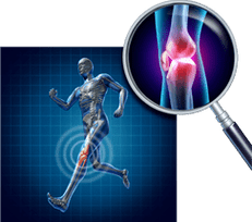 Knee articulation arthrosis